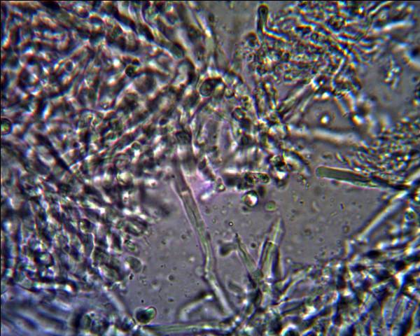 Oligoporus?? (Skeletocutis amorpha)